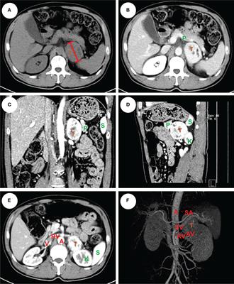 The ADRENAL score: A comprehensive scoring system for standardized evaluation of adrenal tumor